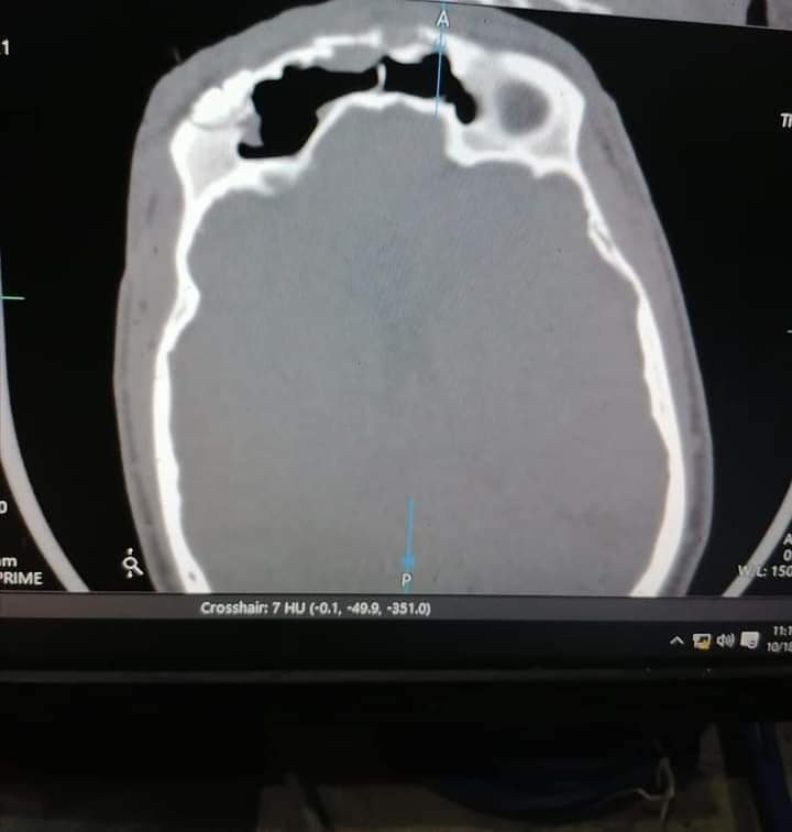 قنا العام تنجح