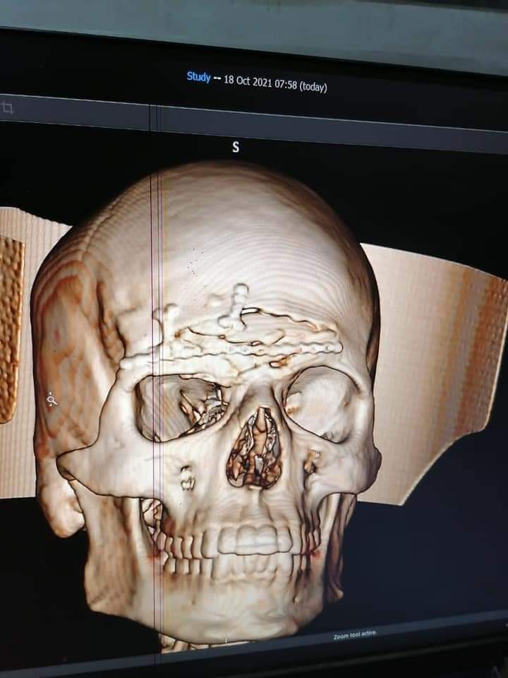 قنا العام تنجح