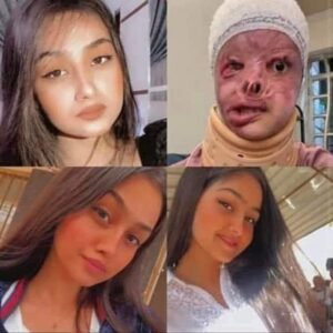 مريم الركابي طالبة تشوه وجهها بسبب شاب فى العراق.